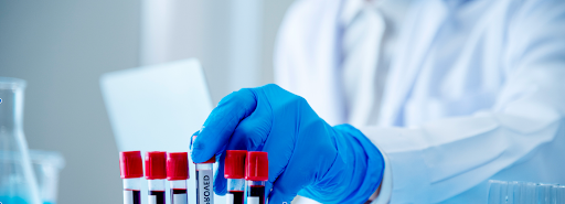 Lab tech handling blood donation samples in vials in accordance with blood donor compliance regulations 